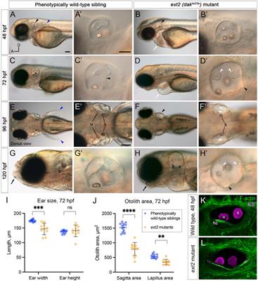 Presence of chondroitin sulphate and requirement for heparan sulphate biosynthesis in the developing zebrafish inner ear